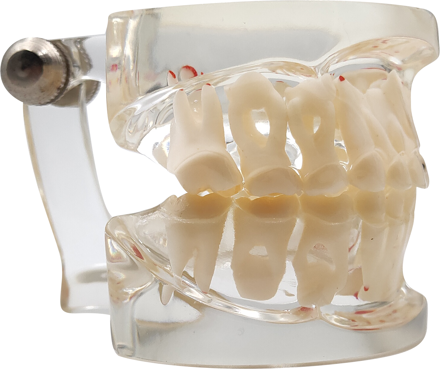 Dental Model For Children Deciduous Tooth Permanent Teeth Alternating Study Teathing Pediatric Dental Pathology Preventive Model