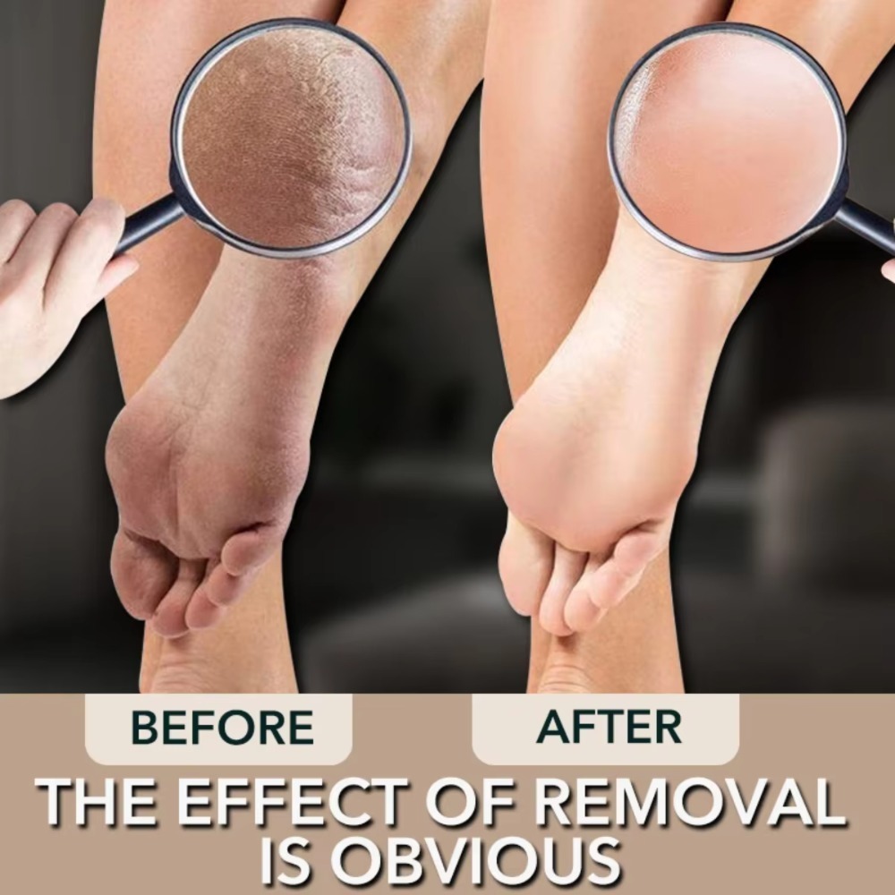 1 Pc Nano Glas Dubbelzijdig Voetrasp Hak Bestand Harde Dode Huid Eelt Remover Exfoliërende Pedicure Zorg Voet bestand Beauty Tools