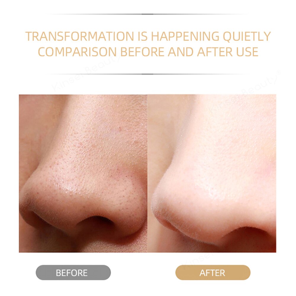 Ultrasonic Atomization Peeling Machine Skin Scrubber Vibration Face Spatula Blackhead Remover Deep Face Cleaning Machine Peel