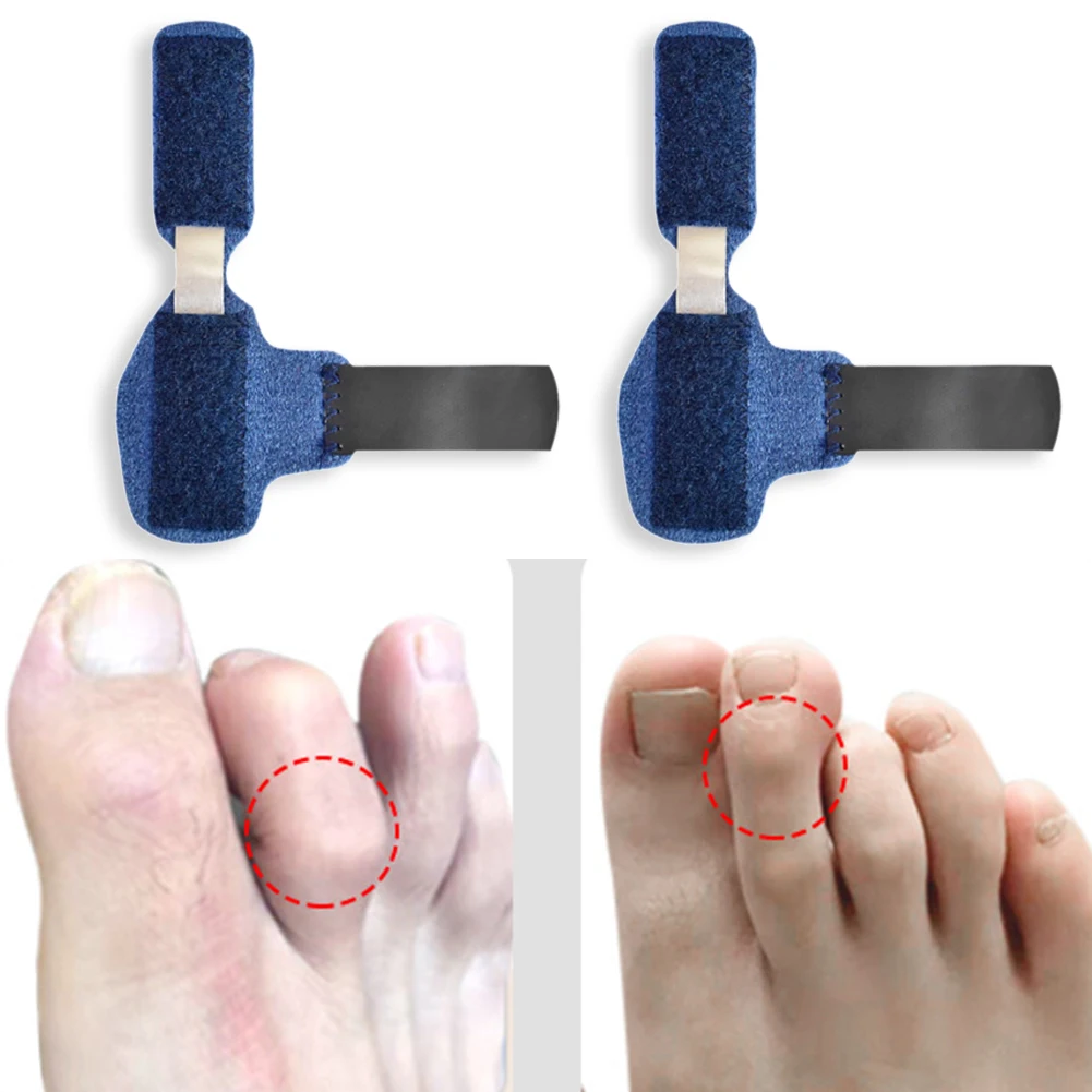 Toe Splint Straightener For Hammer Toe Corrector Crooked Toe Claw Toe Stabilizer Support Brace Wrap Pain Relief Kids Adults