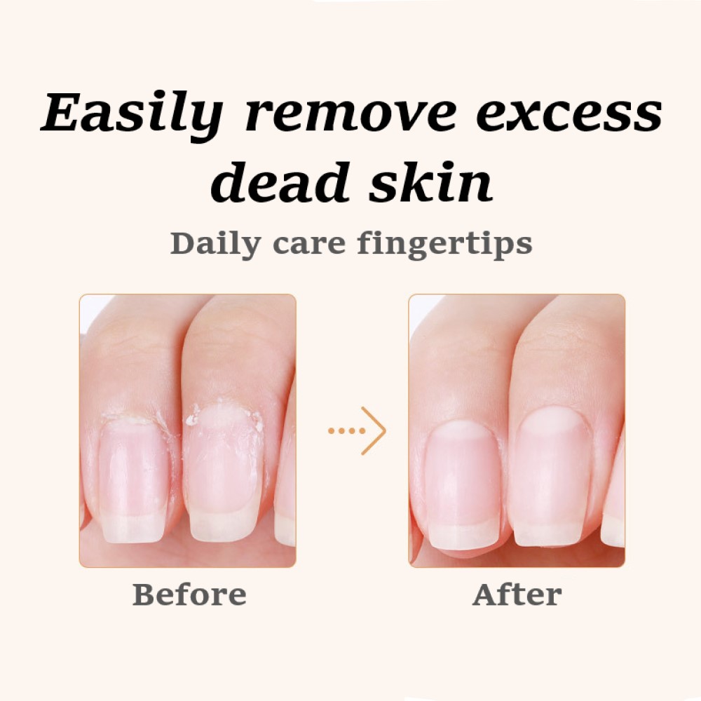 2PCS Ingrown Nail Correction File Lifters Pedicure Tools ToeNail Manicure Kit Foot Care Podiatry Nail Cleaner Feet