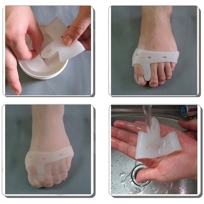 1 paar Siliconen Teen hallux valgus Scheidingsvellen Straighteners Bunion Relief Pads teen separator