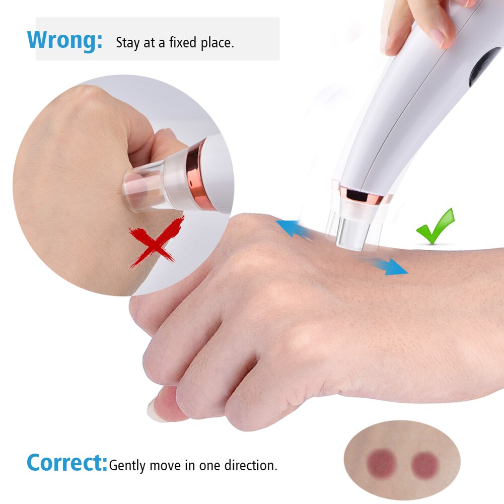 Electric Acne Remover Point Noir Blackhead Vacuum Extractor Tool Black Spots Pore Cleaner Skin Care Facial Pore Cleaner Machine