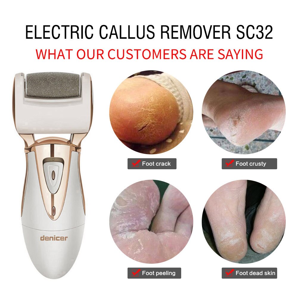 Limas eléctricas para pedicura de pies callos producto para eliminar la piel muerta limas eléctricas para pedicura de piernas limas para pies una herramienta de pedicura para Legscare + bolsa de maquillaje