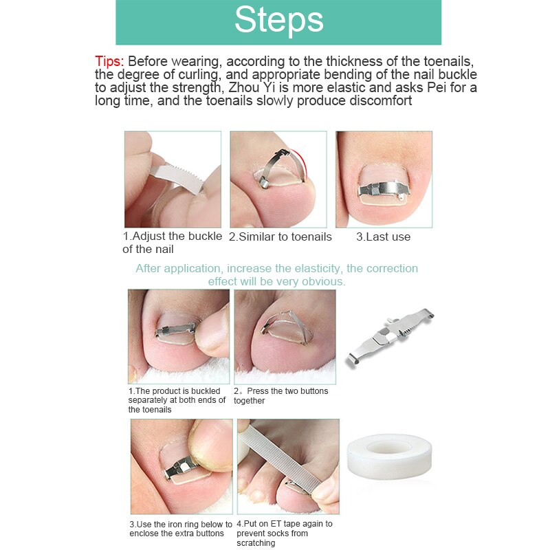 Ongles Boucle De Clip En Acier Inoxydable Incurvé Redresser Ongle Outil Maquettisme Ongles Mieux