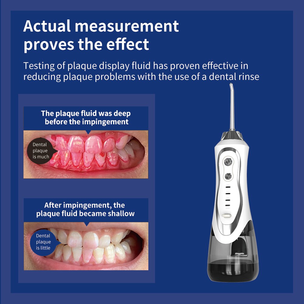 Water Pick Dental Cleaning Electric Tooth Dental Scaler Ultrasound Teeth Care Dental Floss Washing Machine