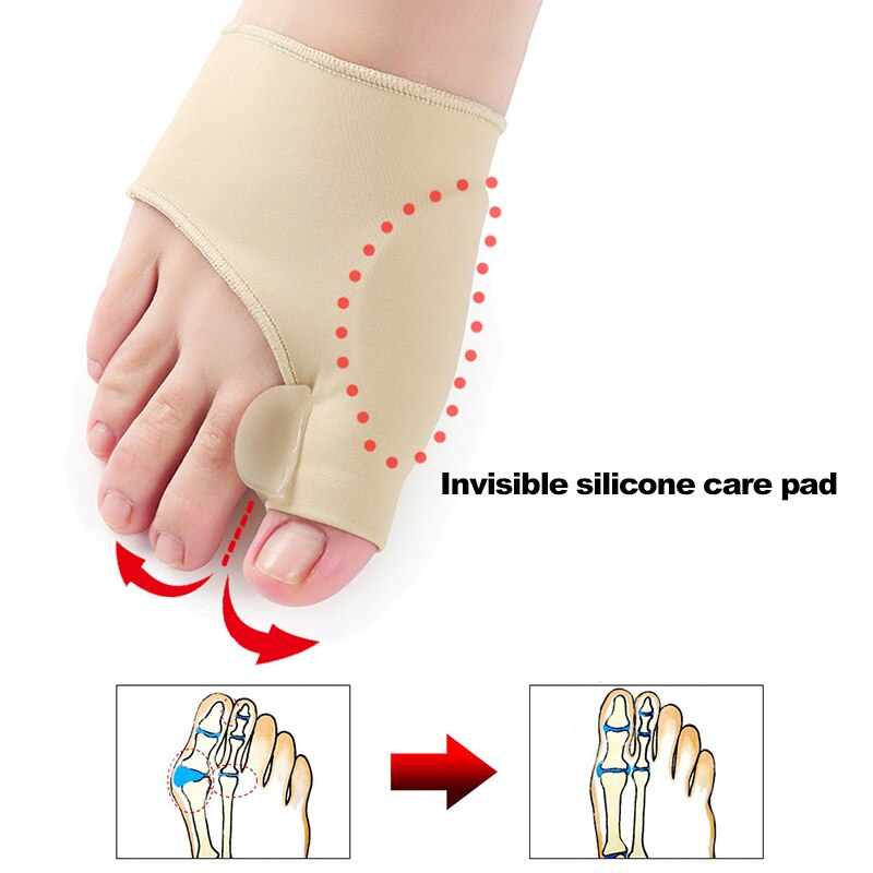 2 stuks = 1 paar sokken met vijf tenen, vingerspreider voor tenen, voetuitlijning, pijnsokken voor vrouwen, sokken voor verlichting van knobbels, bescherming voor pedicure