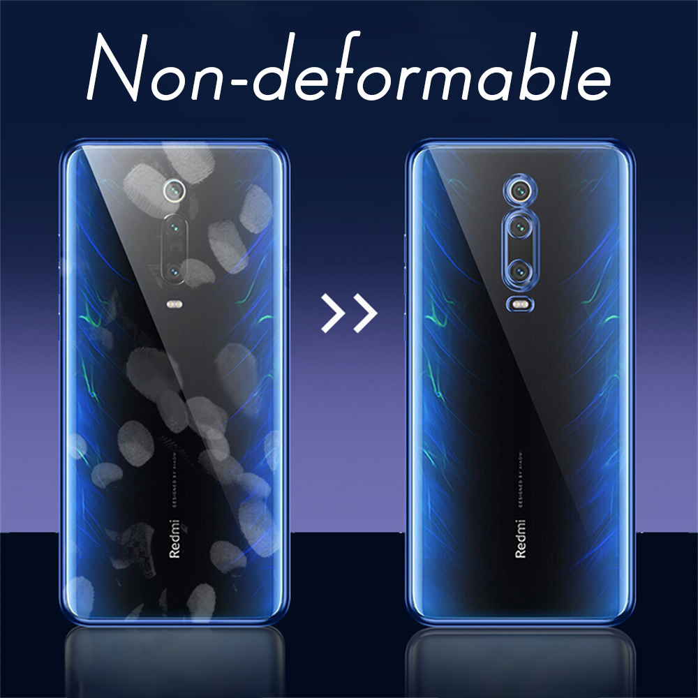 Clear Mode Plating Case Voor Xiaomi Mi 9T Pro Soft Tpu Luxe Telefoon Back Cover Xiaomi9T Mi9T 9Tpro originele Beschermende Fundas