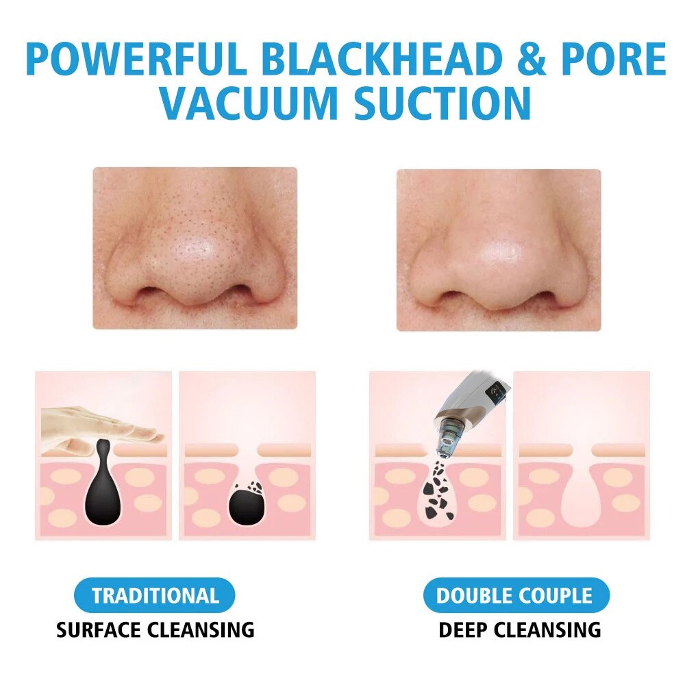 Blackhead Remover Vacuum Suction Face Nose Deep Cleaner Remove Acne Pimple Whitehead Extractor Cleaning Skin Care Tools