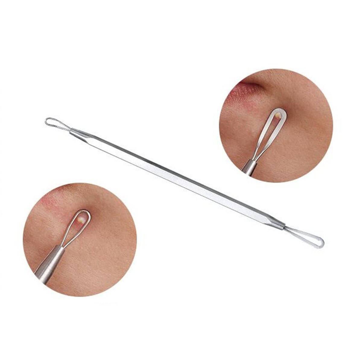 8X Blackhead Whitehead Pimple Spot Comedone Acne Extractor Remover Blemish Tool