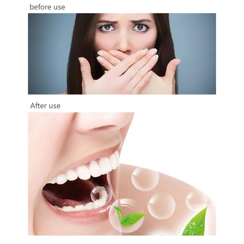 U-förmigen Edelstahl Zunge Mund Reiniger Schaber Frische Atem Hersteller Zahnbürste Reinigung Oral Zahn Hygiene Mundpflege