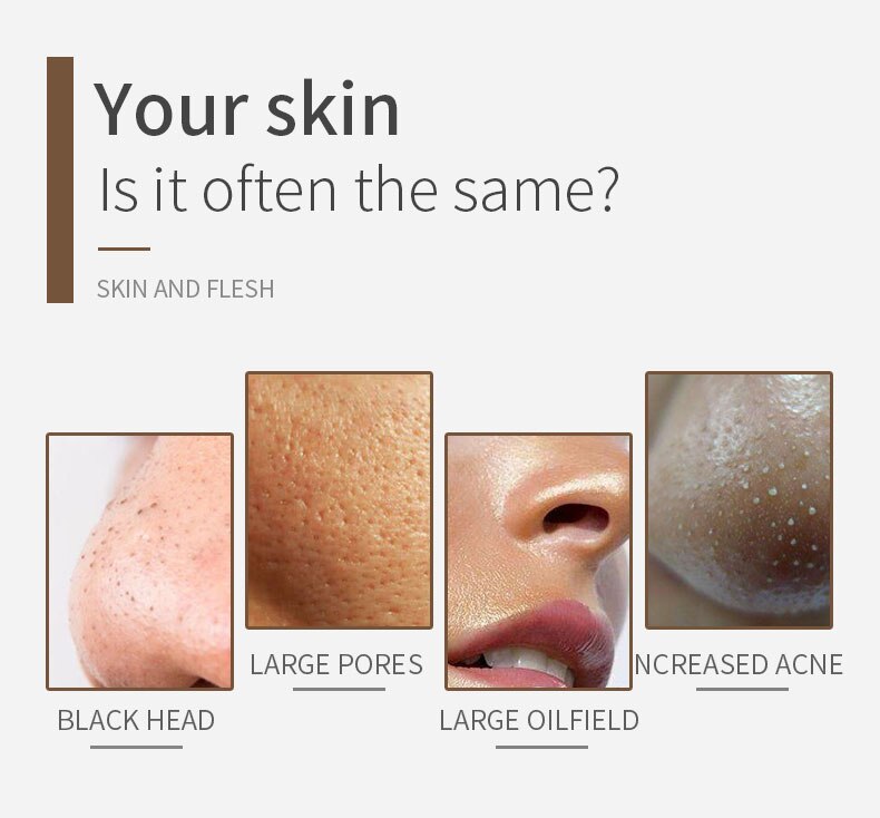 Blackhead Remover Face Deep Nose Cleaner Wifi Beauty Clean Skin Tool Blackhead Black Dot Remover Pore Cleaner 3levels Sucking