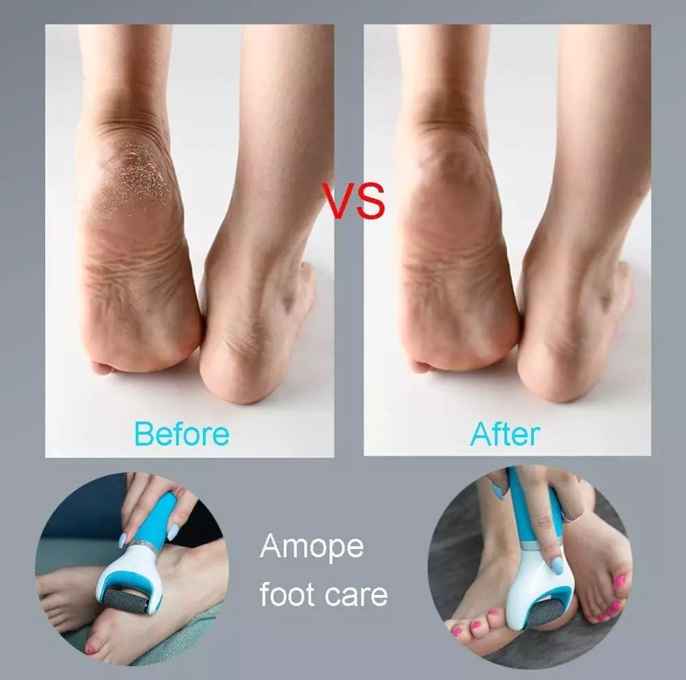 Portable Electric Foot File USB Pedicure Machine Foot Pink Blue Hard Dry Dead Cuticle Skin Remover Home Foot Care Tool