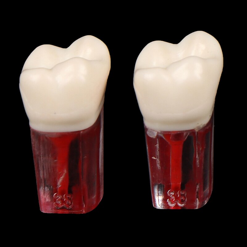 2 uds. De resina endodoncia Dental, modelo de diente Endo, limas de conducto radicular, práctica de pulpa