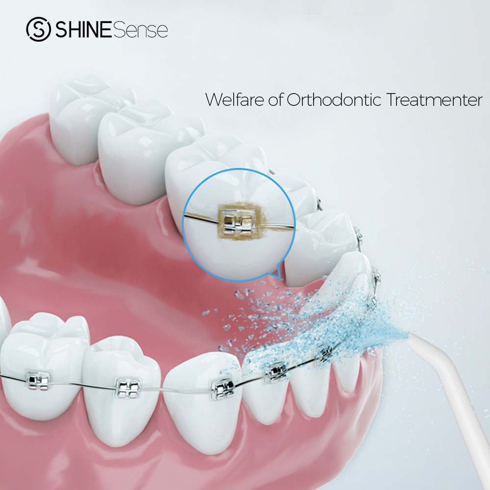 ShineSense Orthodontic Nozzle for Water Flosser Oral Irrigator SIO-200