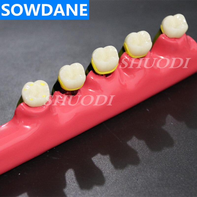 Dental Teeth Model Periodontal Disease Assort Toot Vicedeal Dental teeth model periodontal disease assort toot vicedeal