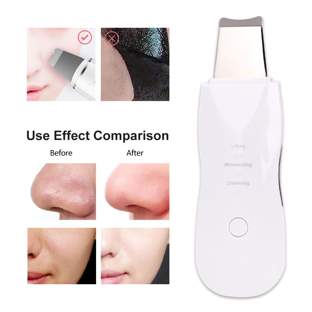 Rechargeable Skin Scrubber Bubble Blackhead Remover Pore Acne Pimple Removal Vacuum Suction Facial Beauty Products Skincare Tool