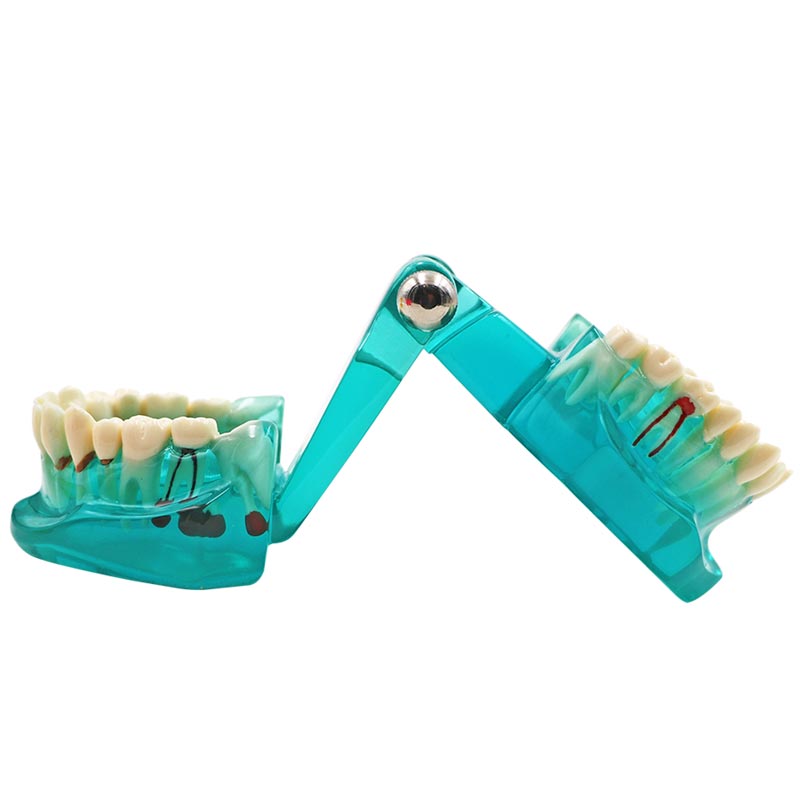 Modèle de dent multicolore, 1 pièce, modèle Standard d&#39;enseignement et d&#39;apprentissage dentaire pour adultes, utilisé dans les cliniques de stomatologie et de recherche