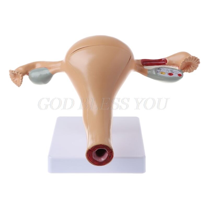 Human Pathological Uterus Ovary Model Anatomical Anatomy Disease Pathology Lesion For Teaching