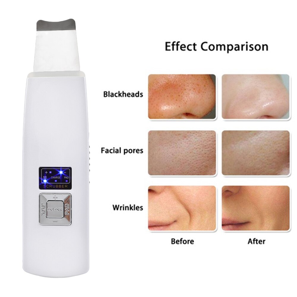 Ultrasonic Face Cleaning Skin Scrubber Facial Cleaner Skin Peeling Blackhead Removal Pore Cleaner Face Scrubber