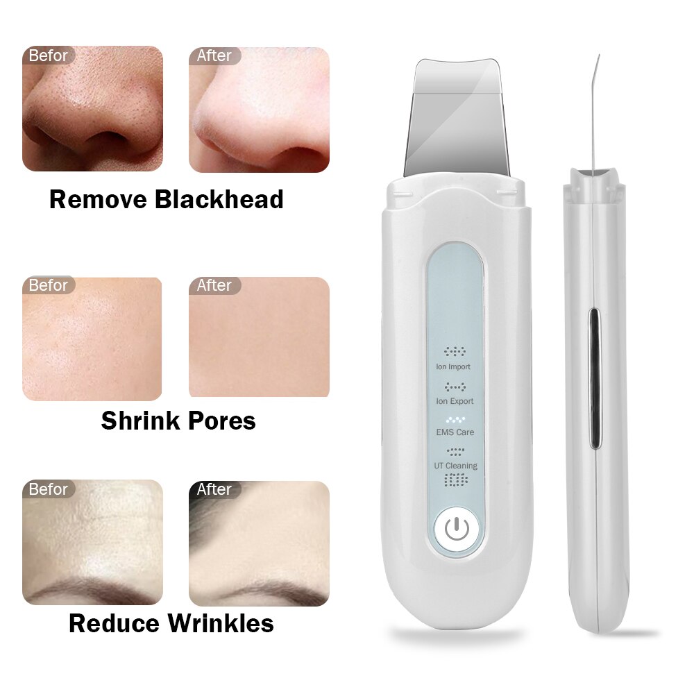 Ultrasone Ion Huid Scrubber Ems Gezicht Massager Facial Reiniging Ion Import Whitening Pore Cleaner Skin Peeling Schop Apparaat