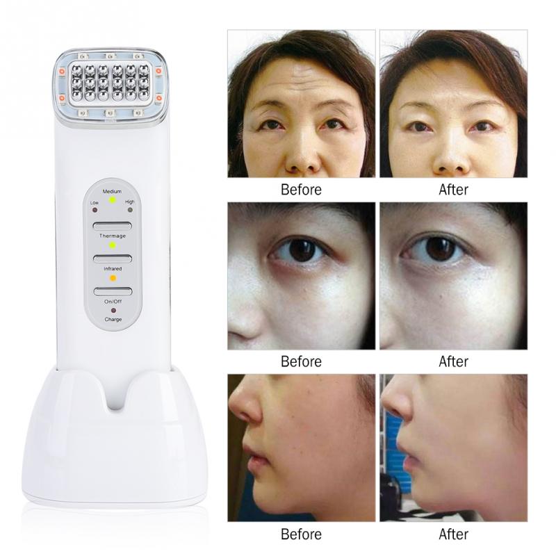 RF Radio Frequency Far-infrared Wave Therapy Skin Rejuvenation Facial Lifting Skin Tightening Facial Wrinkle Removal Machine