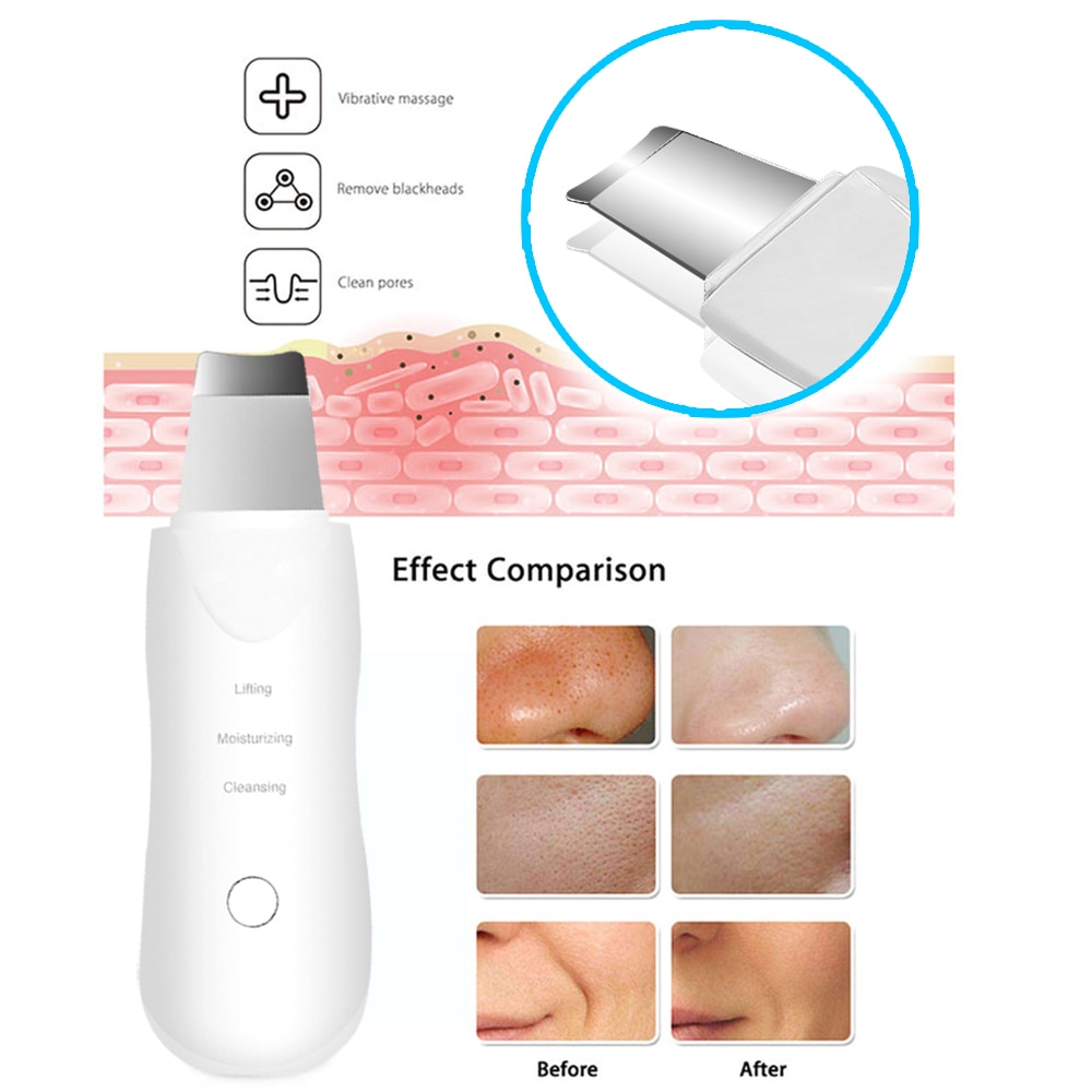 Vibrationsmassage ansigtshudscrubber genopladelig spatel peeling fjern hudorme porer ansigtsrenser maskine