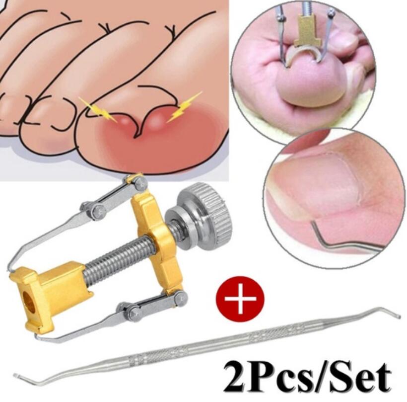 Ingrown Toenails Pedicure Foot Care Tool Nail Correction Clipper Cutters For Orthotic Acronyx Dead Skin Remover Podiatry: 2pcs set B