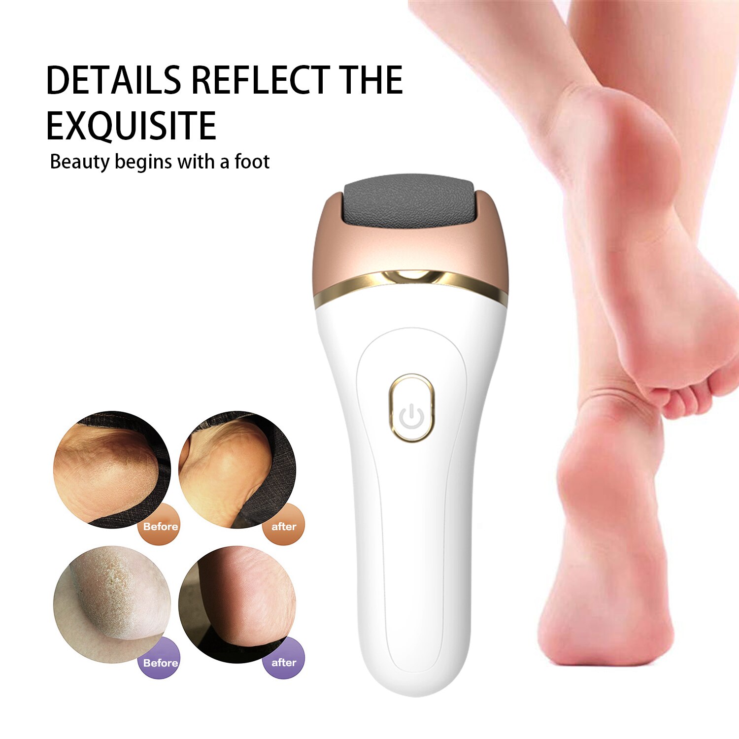 Fichier de pied électrique callosités dissolvant fichiers de pied dur peau morte polisseur exfoliant meulage pédicure pour Machine de soin des pieds: White 263