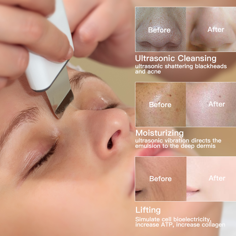 Ultrasonic Skin Scrubber Face Spatula Blackhead Removal Pore Cleanser Skin Peeling Lifting Comedone Extractor Beauty Instrument