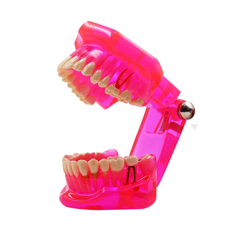Modèle de dent multicolore, 1 pièce, modèle Standard d&#39;enseignement et d&#39;apprentissage dentaire pour adultes, utilisé dans les cliniques de stomatologie et de recherche: Pink