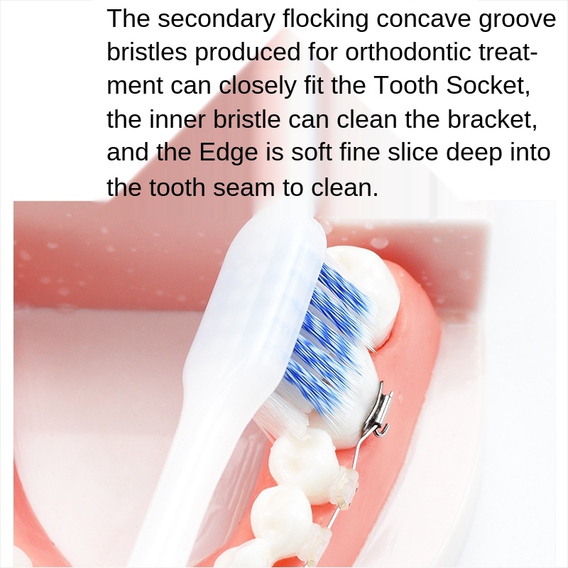 Orthodontic Toothbrush Concave Small Head Soft Bristles Special for Children Adult Orthodontic Braces Braces Toothbrush