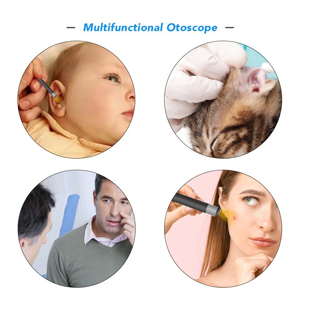 Caméra d'endoscope auriculaire, led réglables, lentille 5.5MM, résolution 640*480, IP67, résistance à l'eau, Otoscope d'inspection