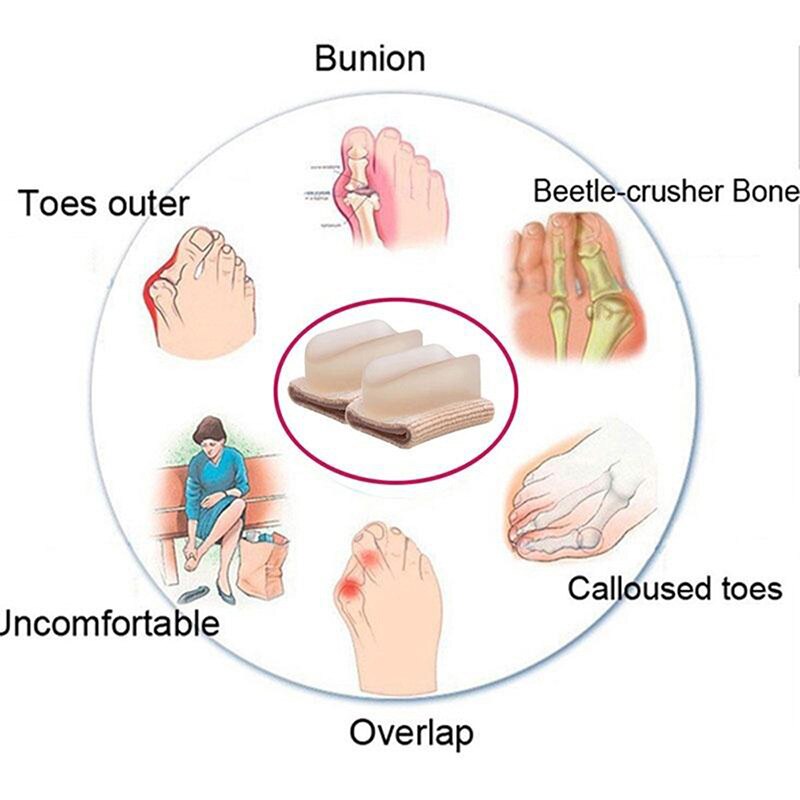 Tåseparator hallux valgus knyst korrektor orthotics fødder knogle tommelfinger justering korrektion pedicure strømpe glattejern