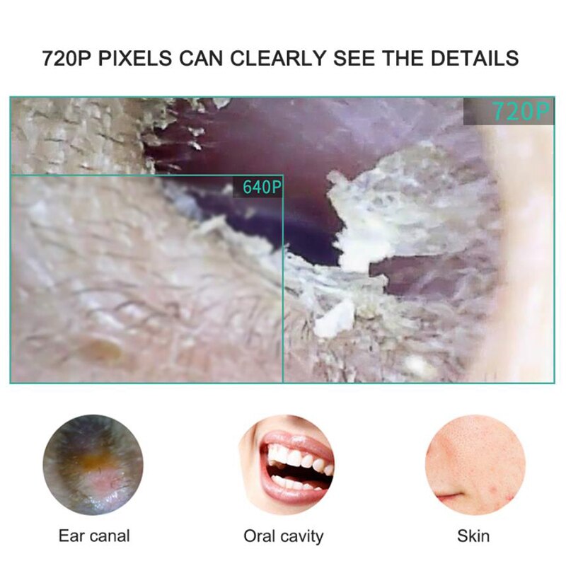 3-in-1 Ear Cleaning Endoscope Mini Camera 5.5mm Borescope Inspection Camera Otoscope Visual Earpick Tool